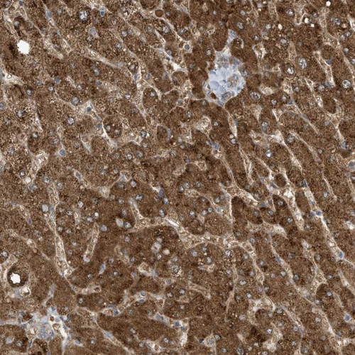 Immunohistochemical staining of human liver shows strong cytoplasmic positivity in hepatocytes.