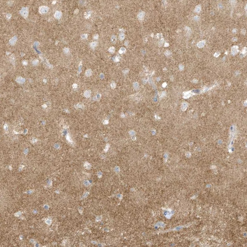 Immunohistochemical staining of human cerebral cortex shows neuropil positivity.