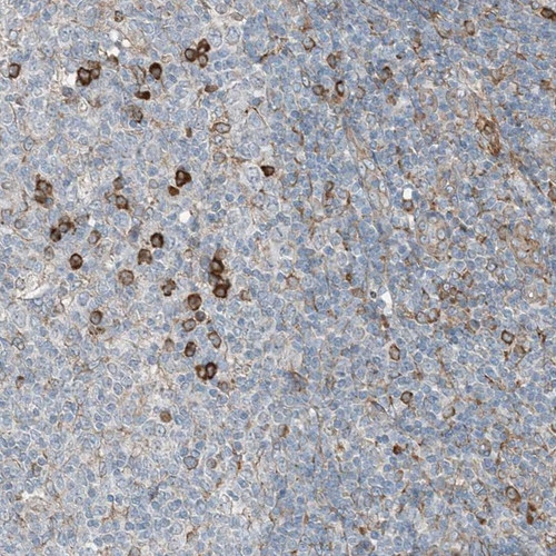 Immunohistochemical staining of human tonsil shows stong cytoplasmic positivity in germinal center cells.