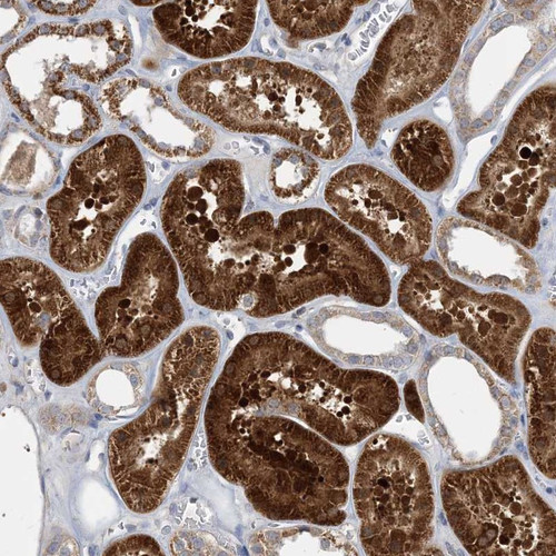 Immunohistochemical staining of human kidney shows strong cytoplasmic positivity in tubular cells.