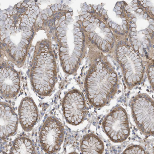 Immunohistochemical staining of human stomach shows moderate membranous positivity in glandular cells.