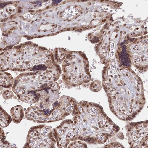 Immunohistochemical staining of human placenta shows moderate nuclear positivity in trophoblastic cells.