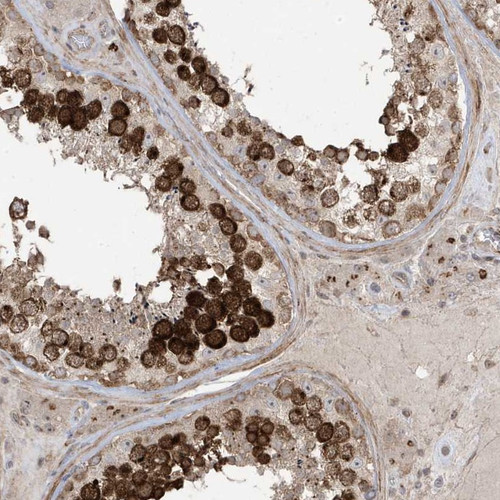 Immunohistochemical staining of human testis shows cytoplasmic and nucleolar positivity in cells in seminiferus ducts.