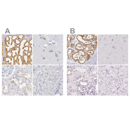 Immunohistochemical staining of human lactating breast, cerebral cortex, kidney and liver using Anti-CSN1S1 antibody HPA035659 (A) shows similar protein distribution across tissues to independent antibody HPA057031 (B).