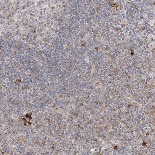 Immunohistochemical staining of human lymph node shows strong cytoplasmic positivity in a subset of non-germinal centre cells.