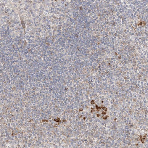 Immunohistochemical staining of human lymph node shows strong cytoplasmic positivity in a subset of non-germinal centre cells.