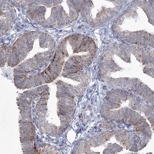 Immunohistochemical staining of human fallopian tube shows moderate cytoplasmic positivity in glandular cells.