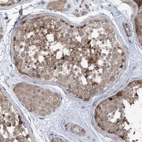 Immunohistochemical staining of human testis shows moderate cytoplasmic positivity in cells in seminiferous ducts.