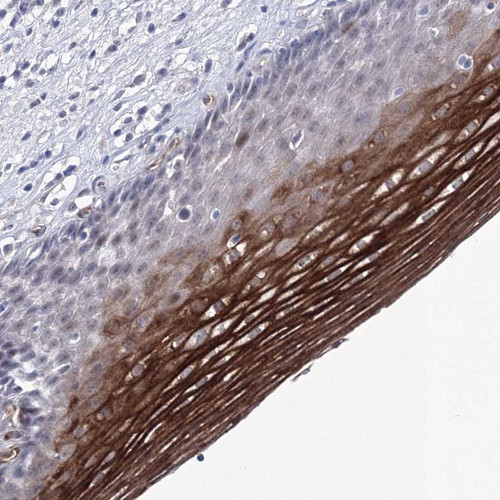 Immunohistochemical staining of human esophagus shows strong positivity in squamous epithelial cells.