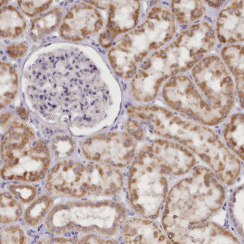 Immunohistochemical staining of human kidney shows moderate cytoplasmic positivity in tubular cells.