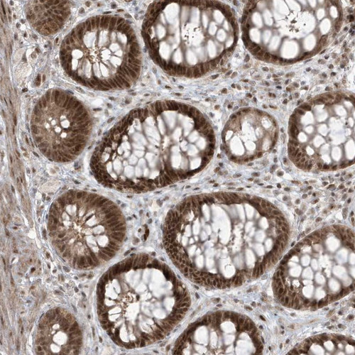 Immunohistochemical staining of human rectum shows strong nuclear and cytoplasmic positivity in glandular cells.