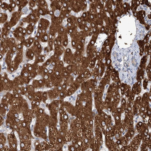 Immunohistochemical staining of human liver shows strong cytoplasmic positivity in hepatocytes.