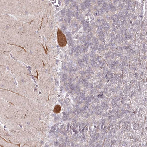 Immunohistochemical staining of human cerebellum shows moderate cytoplasmic positivity in Purkinje cells.