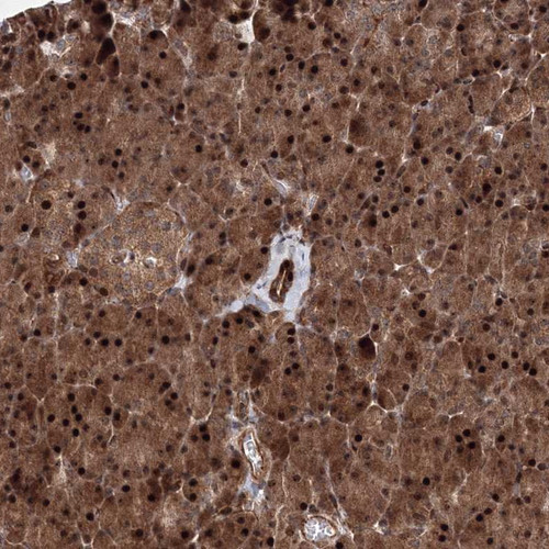 Immunohistochemical staining of human pancreas shows strong nuclear and cytoplasmic positivity in exocrine glandular cells.