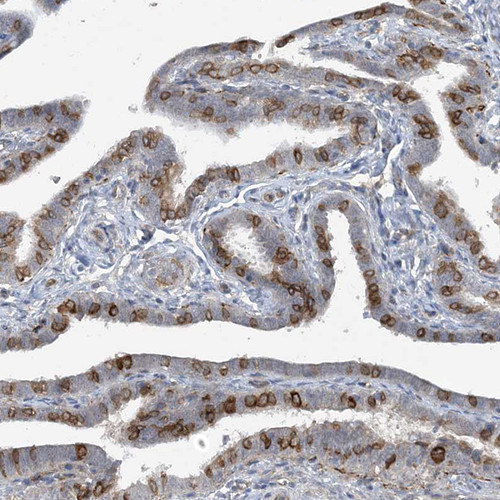 Immunohistochemical staining of human fallopian tube shows moderate membranous positivity in glandular cells.