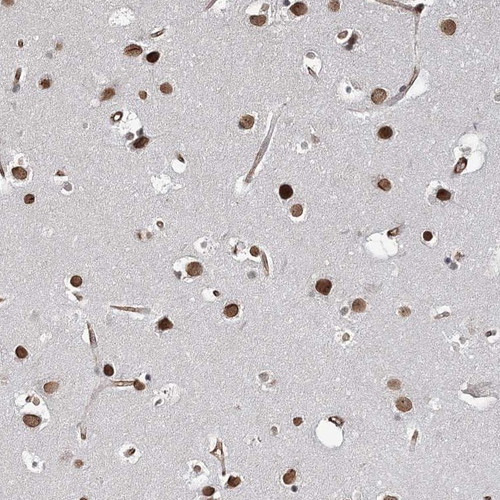 Immunohistochemical staining of human cerebral cortex shows strong nuclear positivity in neuronal cells.