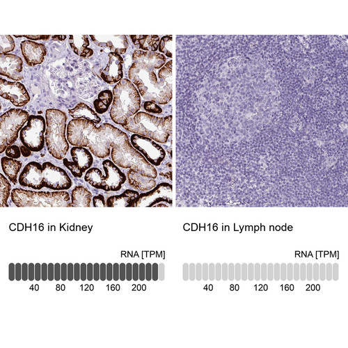 Immunohistochemistry analysis in human kidney and lymph node tissues using Anti-CDH16 antibody. Corresponding CDH16 RNA-seq data are presented for the same tissues.