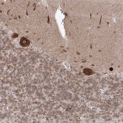 Immunohistochemical staining of human cerebellum shows strong nuclear membrane and cytoplasmic positivity in Purkinje cells.