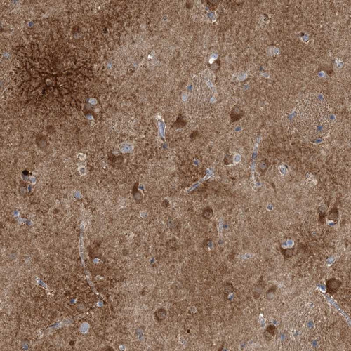 Immunohistochemical staining of human caudate shows strong cytoplasmic positivity in neuronal cells and astrocytes.