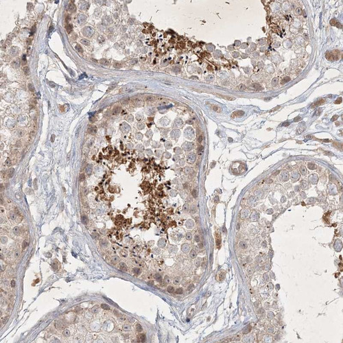 Immunohistochemical staining of human testis shows moderate cytoplasmic positivity in seminiferous ducts.