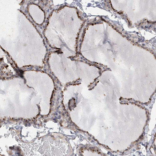 Immunohistochemical staining of human thyroid gland shows distinct cytoplasmic positivity in glandular cells.