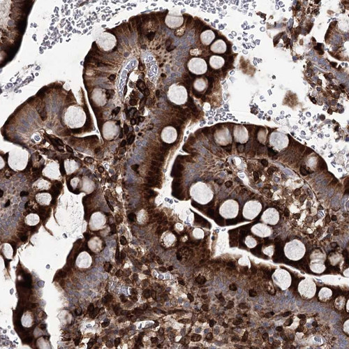 Immunohistochemical staining of human small intestine shows strong cytoplasmic positivity in glandular cells.