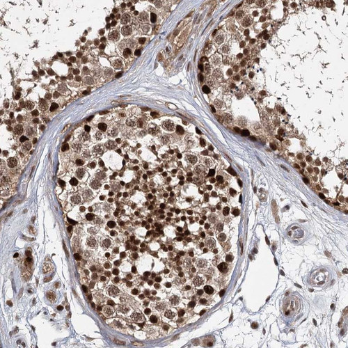 Immunohistochemical staining of human testis shows strong cytoplasmic and nuclear positivity in cells in seminiferus ducts.