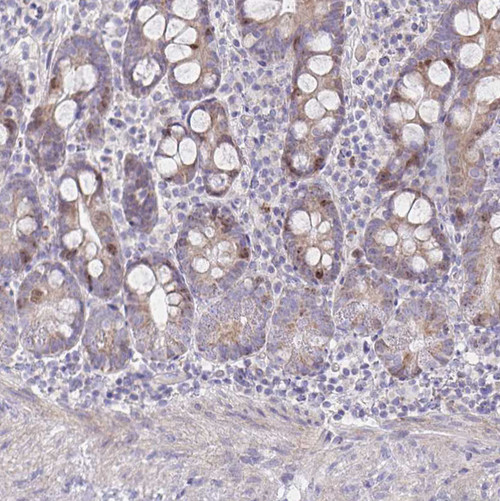 Immunohistochemical staining of human small intestine shows weak to moderate nuclear positivity in a subset of glandular cells.