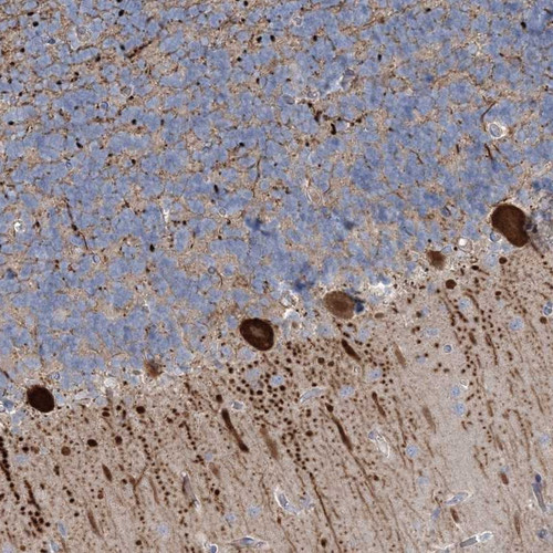Immunohistochemical staining of human cerebellum shows strong cytoplasmic positivity in purkinje cells.
