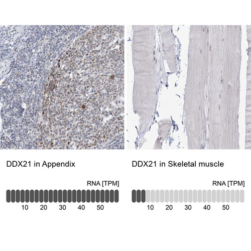 Immunohistochemistry analysis in human appendix and skeletal muscle tissues using HPA036592 antibody. Corresponding DDX21 RNA-seq data are presented for the same tissues.