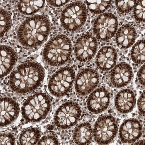 Immunohistochemical staining of human colon shows strong nuclear positivity in glandular cells.