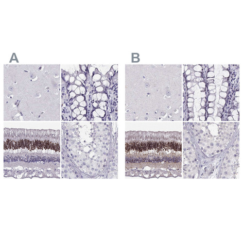 Immunohistochemical staining of human cerebral cortex, colon, eye, retina and testis using Anti-CRX antibody HPA036762 (A) shows similar protein distribution across tissues to independent antibody HPA036763 (B).