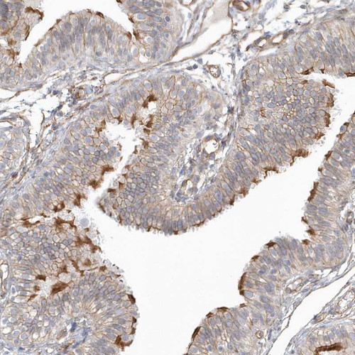 Immunohistochemical staining of human fallopian tube shows membranous positivity in glandular cells.