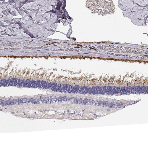 Immunohistochemical staining of human eye, retina shows moderate cytoplasmic and membranous positivity in cells in photoreceptor layer.