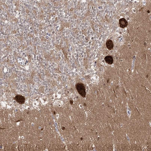 Immunohistochemical staining of human cerebellum shows strong cytoplasmic positivity in purkinje cells.