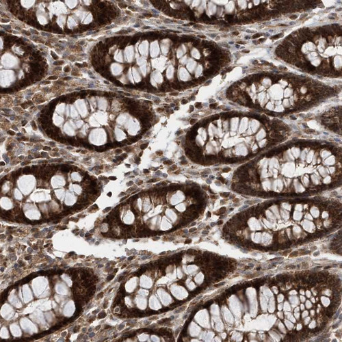 Immunohistochemical staining of human rectum shows strong cytoplasmic positivity in glandular cells.