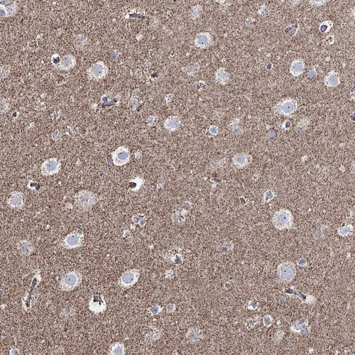 Immunohistochemical staining of human testis shows moderate cytoplasmic positivity in cells in seminiferous ducts and Leydig cells.