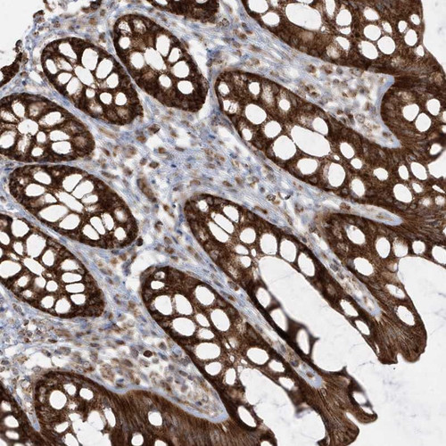 Immunohistochemical staining of human rectum shows strong cytoplasmic positivity in glandular cells.