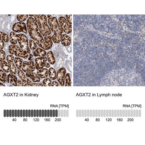 Immunohistochemistry analysis in human kidney and lymph node tissues using Anti-AGXT2 antibody. Corresponding AGXT2 RNA-seq data are presented for the same tissues.
