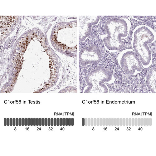 Immunohistochemistry analysis in human testis and endometrium tissues using Anti-C1orf56 antibody. Corresponding C1orf56 RNA-seq data are presented for the same tissues.