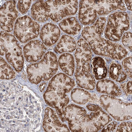 Immunohistochemical staining of human kidney shows strong cytoplasmic positivity in cells in tubules.