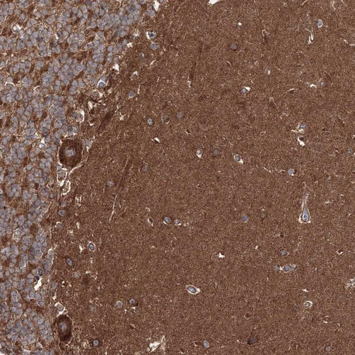 Immunohistochemical staining of human cerebellum shows strong cytoplasmic positivity in Purkinje cells and neuropil was distinctly stained. .
