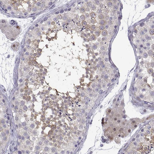 Immunohistochemical staining of human testis shows moderate cytyoplasmic positivity in cells in seminiferous ducts.