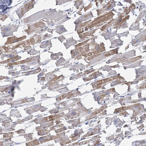Immunohistochemical staining of human heart muscle shows moderate cytoplasmic positivity in myocytes.