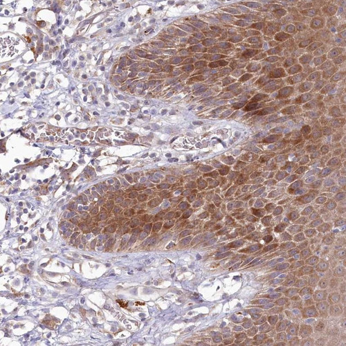 Immunohistochemical staining of human skin shows cytoplasmic positivity in epidermal cells.