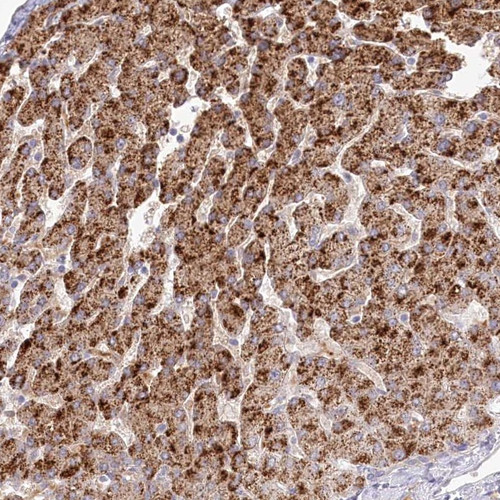 Immunohistochemical staining of human liver shows strong cytoplasmic positivity in hepatocytes.