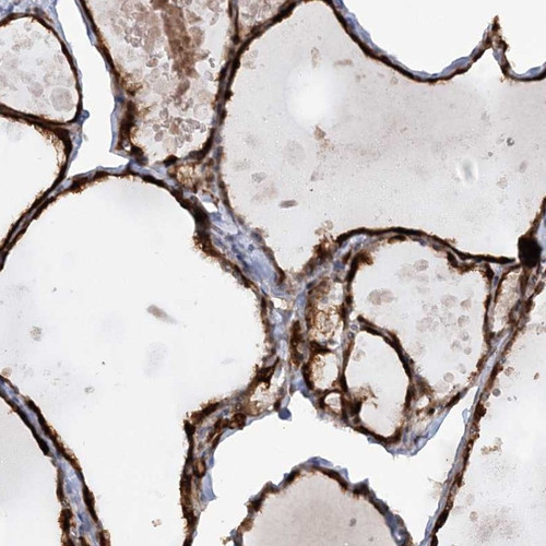 Immunohistochemical staining of human thyroid gland shows strong cytoplasmic positivity in glandular cells.