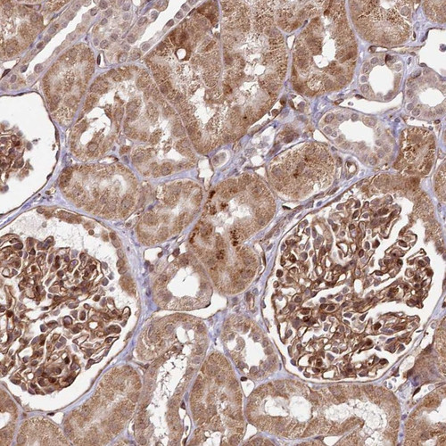 Immunohistochemical staining of human kidney shows strong cytoplasmic positivity in cells in tubules.