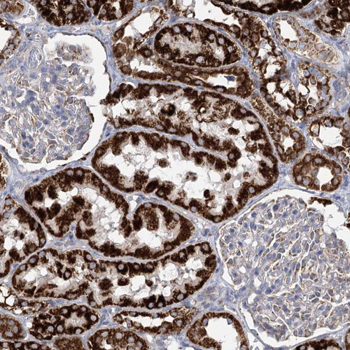 Immunohistochemical staining of human kidney shows strong cytoplasmic positivity in cells in tubules.