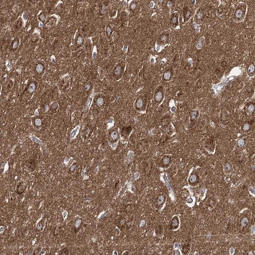 Immunohistochemical staining of human hippocampus shows strong cytoplasmic positivity in neuronal cells.